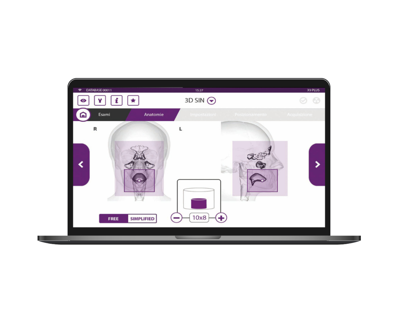 MyRay: Intraoral and Extraoral Dental Radiography Equipment